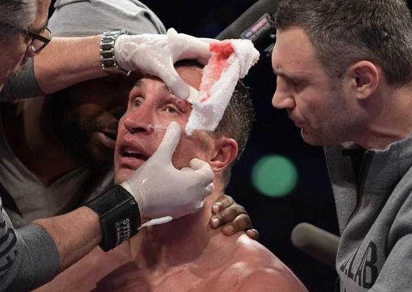 What Betting Tips Can You Learn from Cutmen and Corner Observations